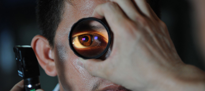 Solar Eclipse Eye Damage Symptoms